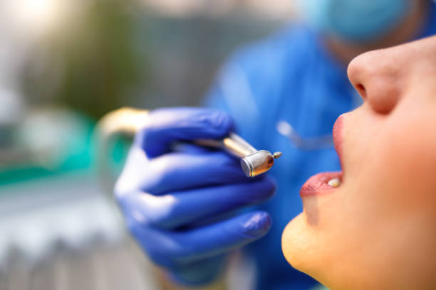 Dental Bonding in Byron, CA